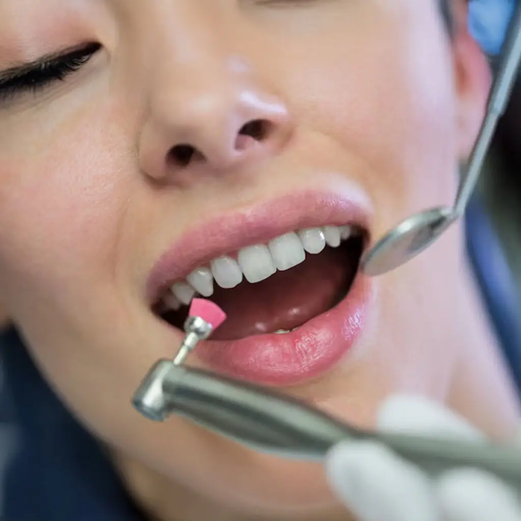 How Long Does Composite Bonding Lasts: Tips for Maximising the Lifespan of Your Bonded Smile